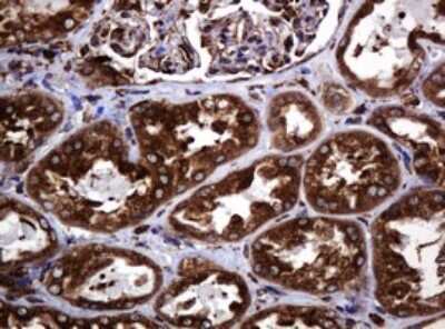 Immunohistochemistry: POGK Antibody (OTI6D5) [NBP2-45364]