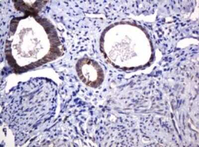 Immunohistochemistry: POGK Antibody (OTI6D5) [NBP2-45364]