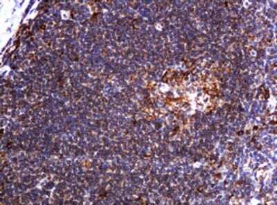 Immunohistochemistry: POGK Antibody (OTI6D5) [NBP2-45364]