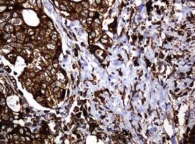 Immunohistochemistry: POGK Antibody (OTI6D5) [NBP2-45364]