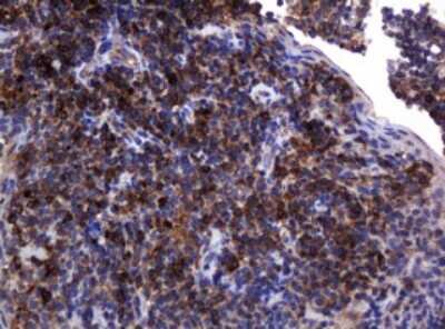 Immunohistochemistry: POGK Antibody (OTI6D5) [NBP2-45364]