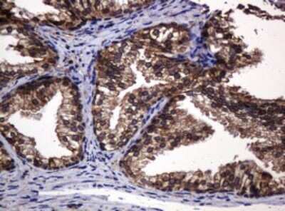 Immunohistochemistry: POGK Antibody (OTI6D5) [NBP2-45364]