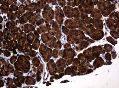 Immunohistochemistry: POGK Antibody (OTI6D5) [NBP2-45364]