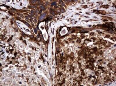 Immunohistochemistry: POGK Antibody (OTI6D5) [NBP2-45364]