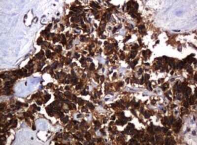 Immunohistochemistry: POGK Antibody (OTI6D5) [NBP2-45364]