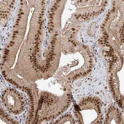 Immunohistochemistry-Paraffin: POGK Antibody [NBP1-88705]