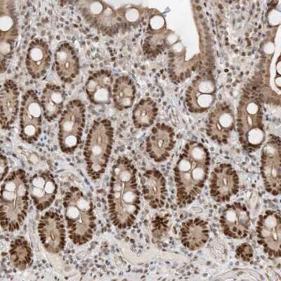 Immunohistochemistry-Paraffin: POGK Antibody [NBP1-88705]