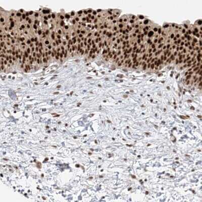 Immunohistochemistry-Paraffin: POGK Antibody [NBP1-88705]