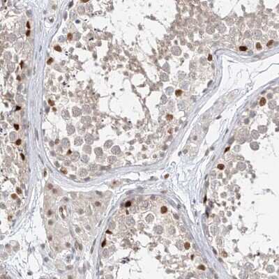 Immunohistochemistry-Paraffin: POGK Antibody [NBP1-88705]