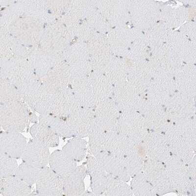 Immunohistochemistry-Paraffin: POGK Antibody [NBP1-88705]
