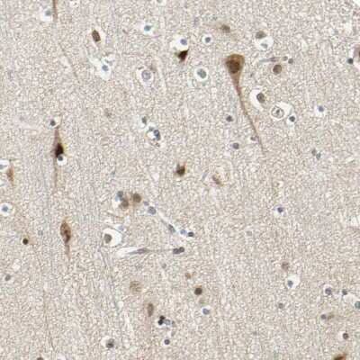 Immunohistochemistry-Paraffin: POGZ Antibody [NBP1-83004]