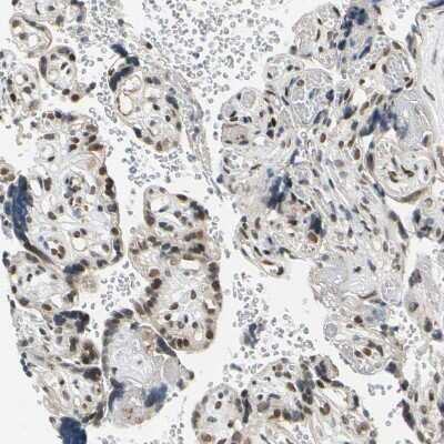 Immunohistochemistry-Paraffin: POGZ Antibody [NBP1-83004]