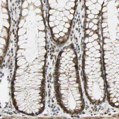 Immunohistochemistry-Paraffin: POGZ Antibody [NBP1-83004]