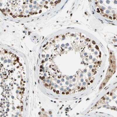 Immunohistochemistry-Paraffin: POGZ Antibody [NBP1-83004]