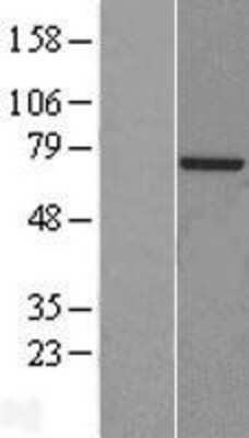 Western Blot: POLA2 Overexpression Lysate [NBL1-14566]