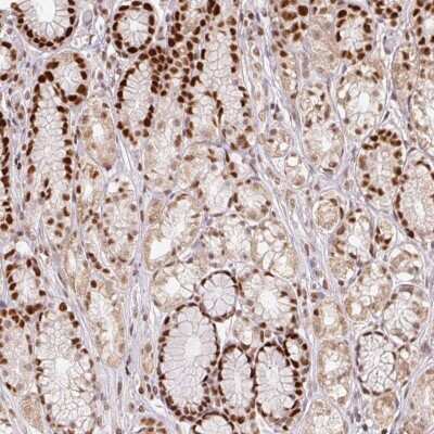 Immunohistochemistry: POLD3 Antibody [NBP2-38862]