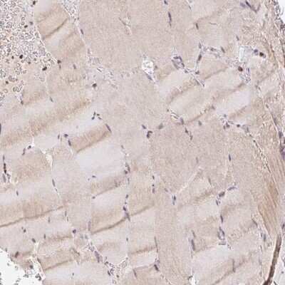 Immunohistochemistry-Paraffin: POLD3 Antibody [NBP2-38862]