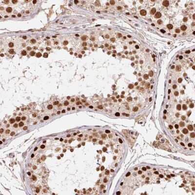 Immunohistochemistry-Paraffin: POLD3 Antibody [NBP2-38862]