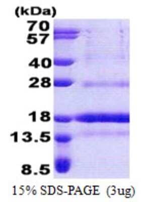 SDS-PAGE: Recombinant Human POLD4 His Protein [NBP2-23342]