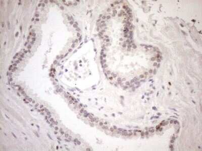 Immunohistochemistry: POLDIP1 Antibody (OTI3B12) [NBP2-45472]