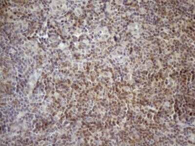 Immunohistochemistry: POLDIP1 Antibody (OTI3B12) [NBP2-45472]