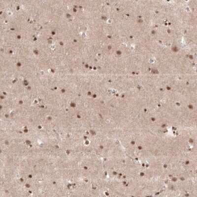 Immunohistochemistry-Paraffin: POLDIP1 Antibody [NBP2-14147]