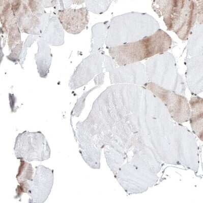 Immunohistochemistry-Paraffin: POLDIP1 Antibody [NBP2-14147]