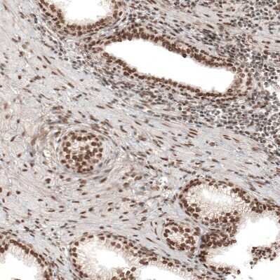 Immunohistochemistry-Paraffin: POLDIP1 Antibody [NBP2-14147]