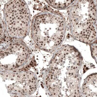 Immunohistochemistry-Paraffin: POLDIP1 Antibody [NBP2-14147]