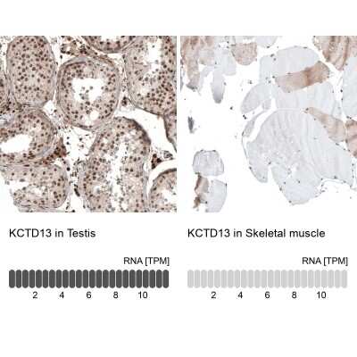 Immunohistochemistry-Paraffin: POLDIP1 Antibody [NBP2-14147]