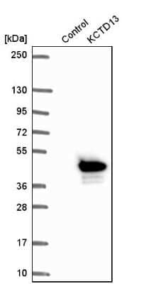 Western Blot: POLDIP1 Antibody [NBP2-14147]