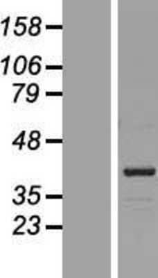 Western Blot: POLDIP1 Overexpression Lysate [NBL1-12210]