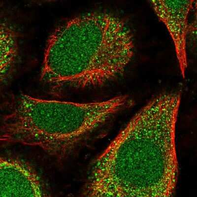 Immunocytochemistry/ Immunofluorescence: POLE4 Antibody [NBP2-54947]