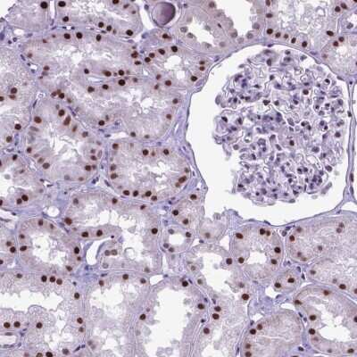 Immunohistochemistry: POLE4 Antibody [NBP2-49672]