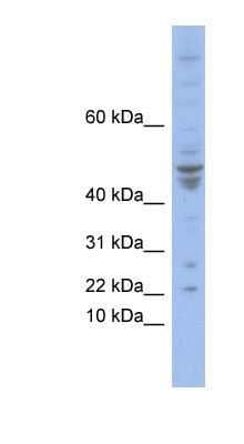 Western Blot: POLE4 Antibody [NBP1-80344]