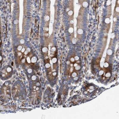 Immunohistochemistry-Paraffin: POLG2 Antibody [NBP1-83227]