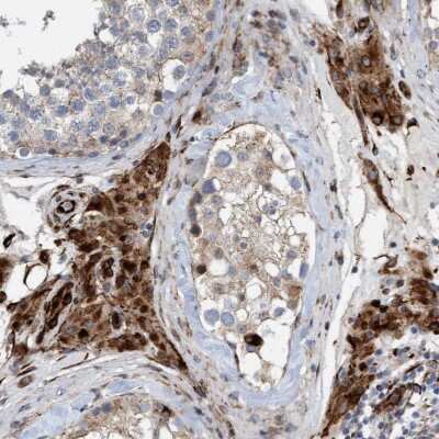 Immunohistochemistry-Paraffin: POLG2 Antibody [NBP1-83227]
