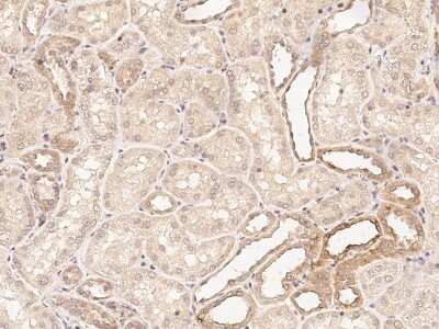 Immunohistochemistry-Paraffin: POLG2 Antibody [NBP2-99015]