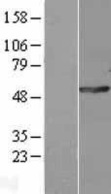 Western Blot: POLG2 Overexpression Lysate [NBL1-14572]