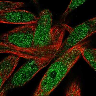 Immunocytochemistry/ Immunofluorescence: POLN Antibody [NBP2-58779]