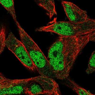 Immunocytochemistry/ Immunofluorescence: POLN Antibody [NBP2-58780]