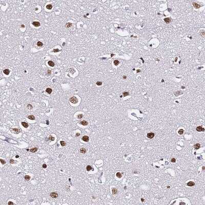 Immunohistochemistry-Paraffin: POLR1A Antibody [NBP2-32016]
