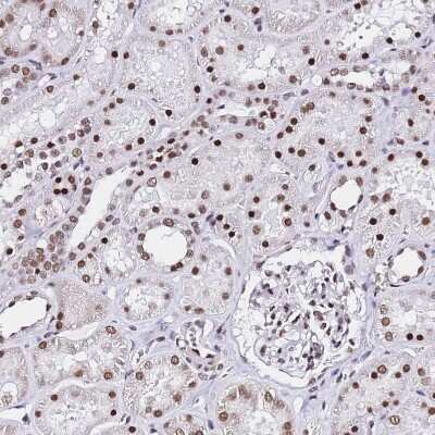 Immunohistochemistry-Paraffin: POLR1A Antibody [NBP2-32016]
