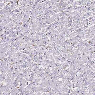 Immunohistochemistry-Paraffin: POLR1A Antibody [NBP2-32016]