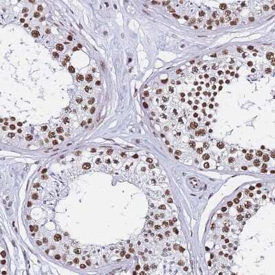 Immunohistochemistry-Paraffin: POLR1A Antibody [NBP2-32016]