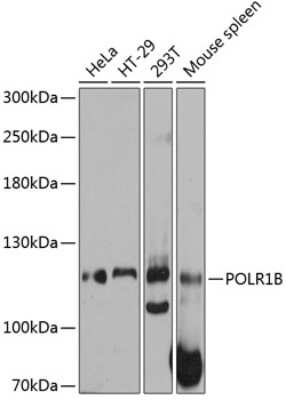 Western Blot: POLR1B AntibodyAzide and BSA Free [NBP2-93757]