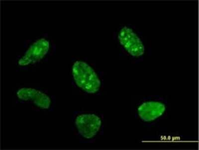 Immunocytochemistry/ Immunofluorescence: POLR1C Antibody (2A5-A5) [H00009533-M02]