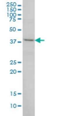 Western Blot: POLR1C Antibody (2E11) [H00009533-M03]