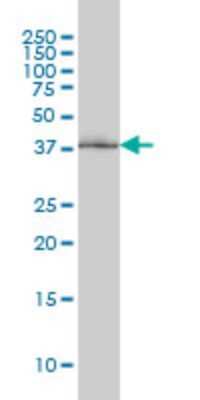 Western Blot: POLR1C Antibody (3A5-H2) [H00009533-M01]