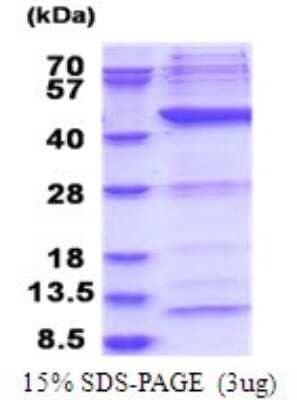 SDS-PAGE: Recombinant Human POLR1C His Protein [NBP2-51765]